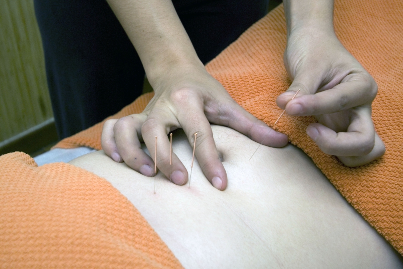 osteopathe-SALERNES-min_acupuncture-4175625